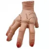 Routine Hand Amputation