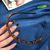 Tiger'S Eye